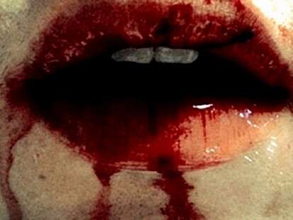 rot-polon-krovi-i-zubov-pohozhe-na-linjku.xxl