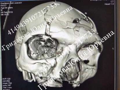 51349588_782321985500140_3942058595020963840_n