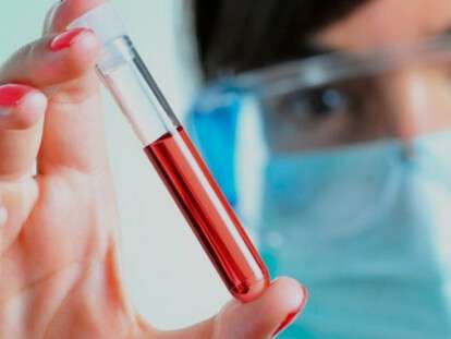 krov-iz-veny-u-grudnichka