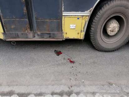 Под Днепром троллейбус переехал ногу пожилой женщине (Фото)