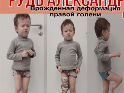 нож