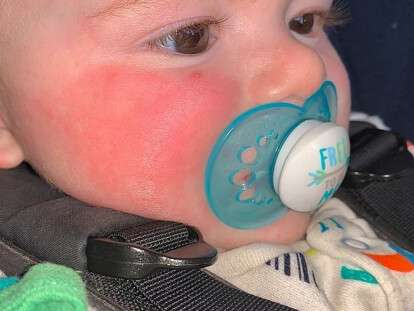 24686954-7999099-gemmaadamsonssixmontholdsonjessewasleftwithapainful-a