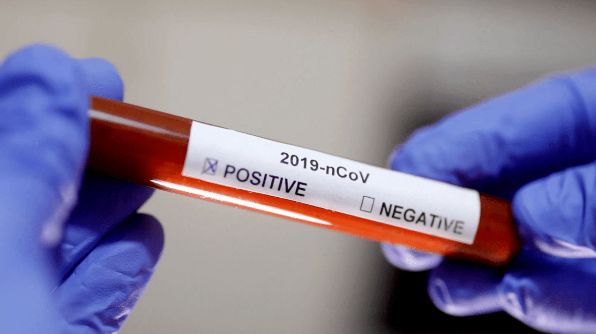 koronavirus_covid-19_positive_test
