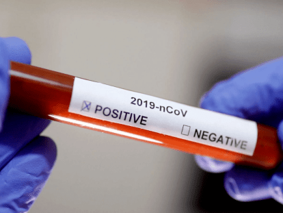 koronavirus_covid-19_positive_test