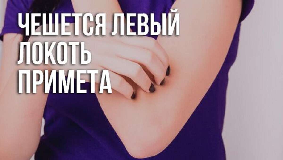 К чему чешется левый локоть. Чешется левый локоть примета. К чему чешется локоть на левой руке. К ЧЕМВ чешетсч левыйлокоть.