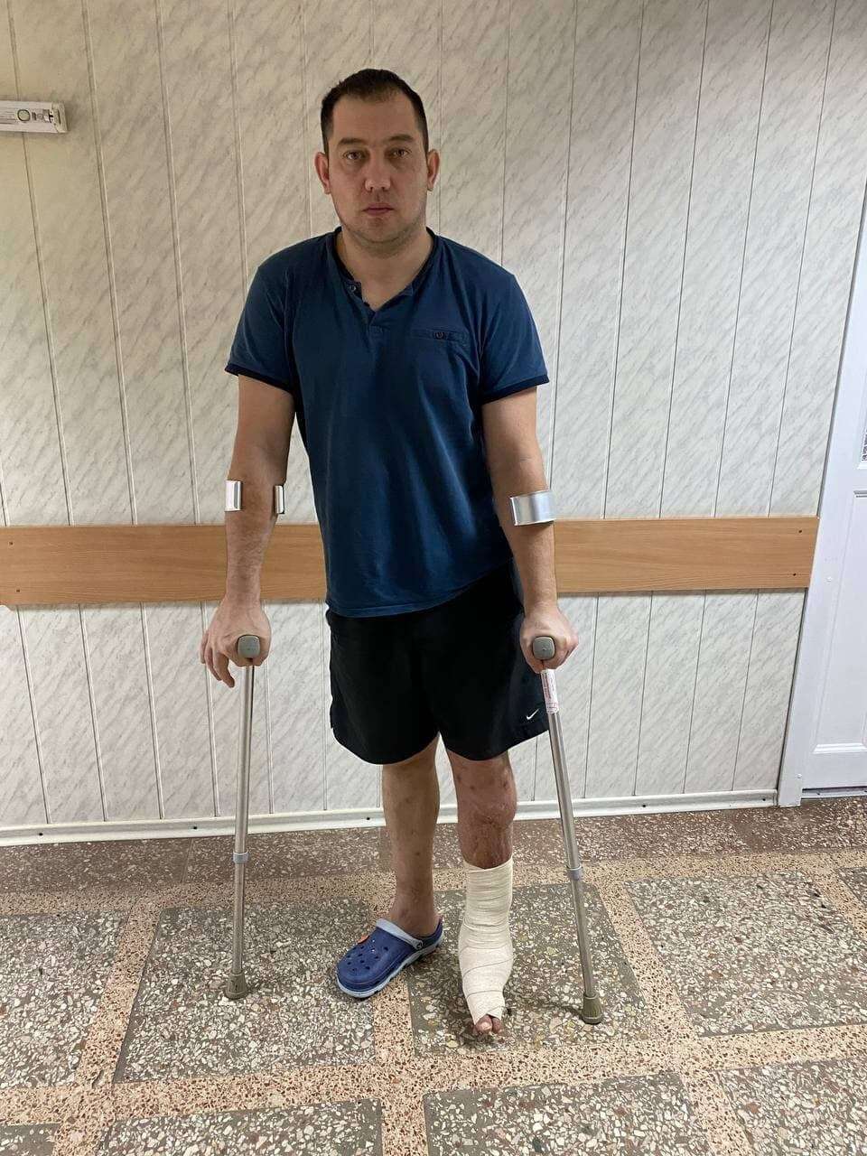 в Днепре в больнице Мечникова спасли ногу военному