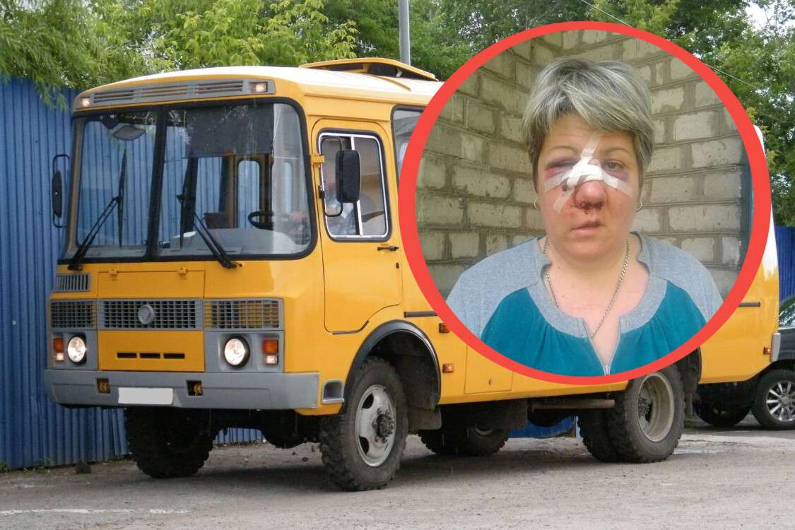 Женщина получила травму в автобусе
