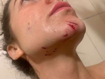 вцепилаь собака