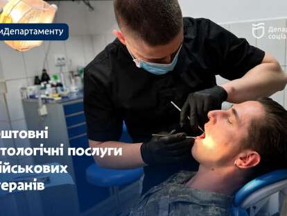 стома
